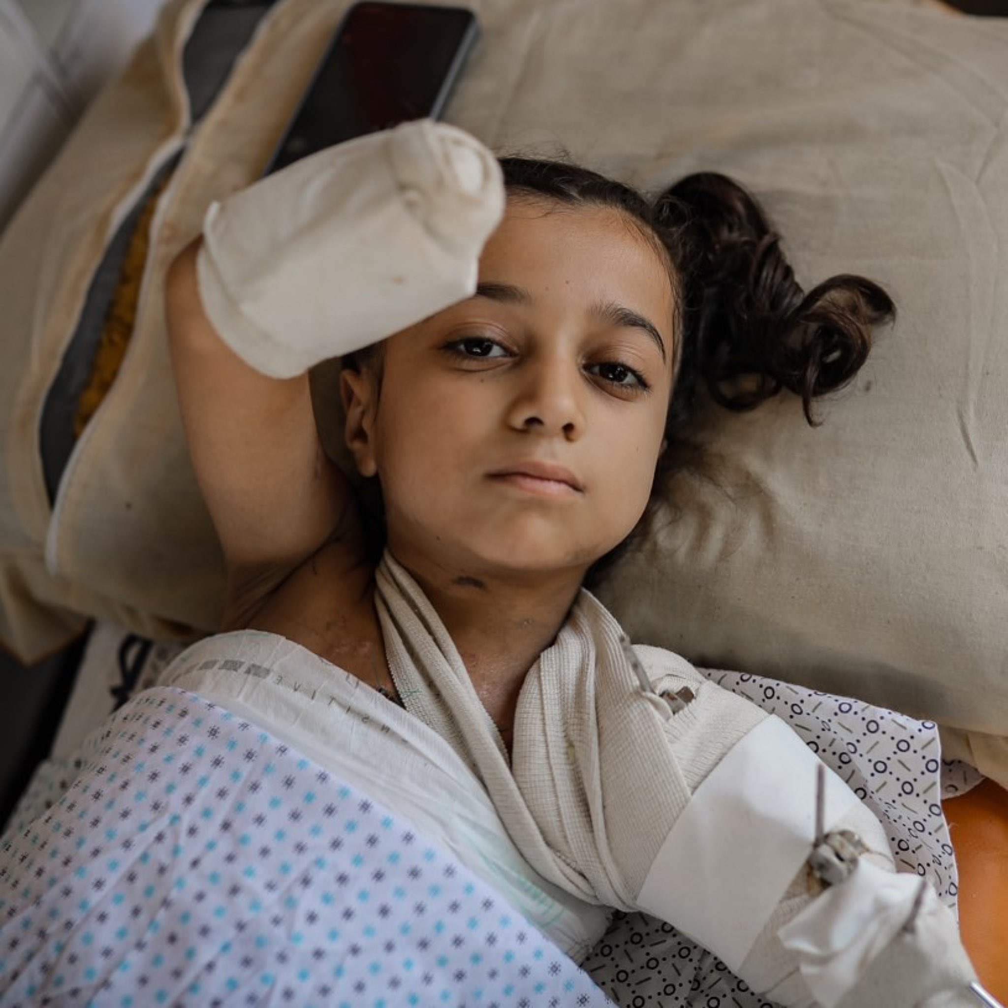 Ghina, 10, loses her right hand in an Israeli airstrike