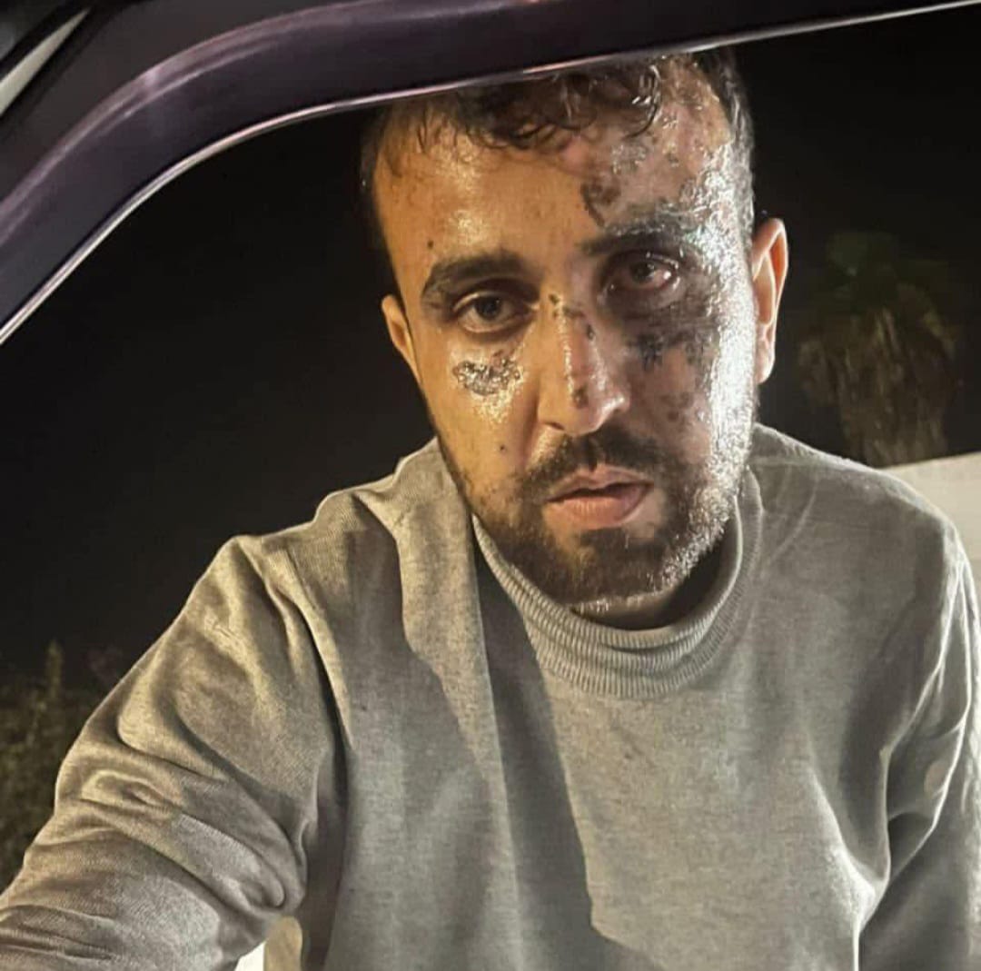 Journalist Wael Abu Zainah loses father in Gaza airstrikes