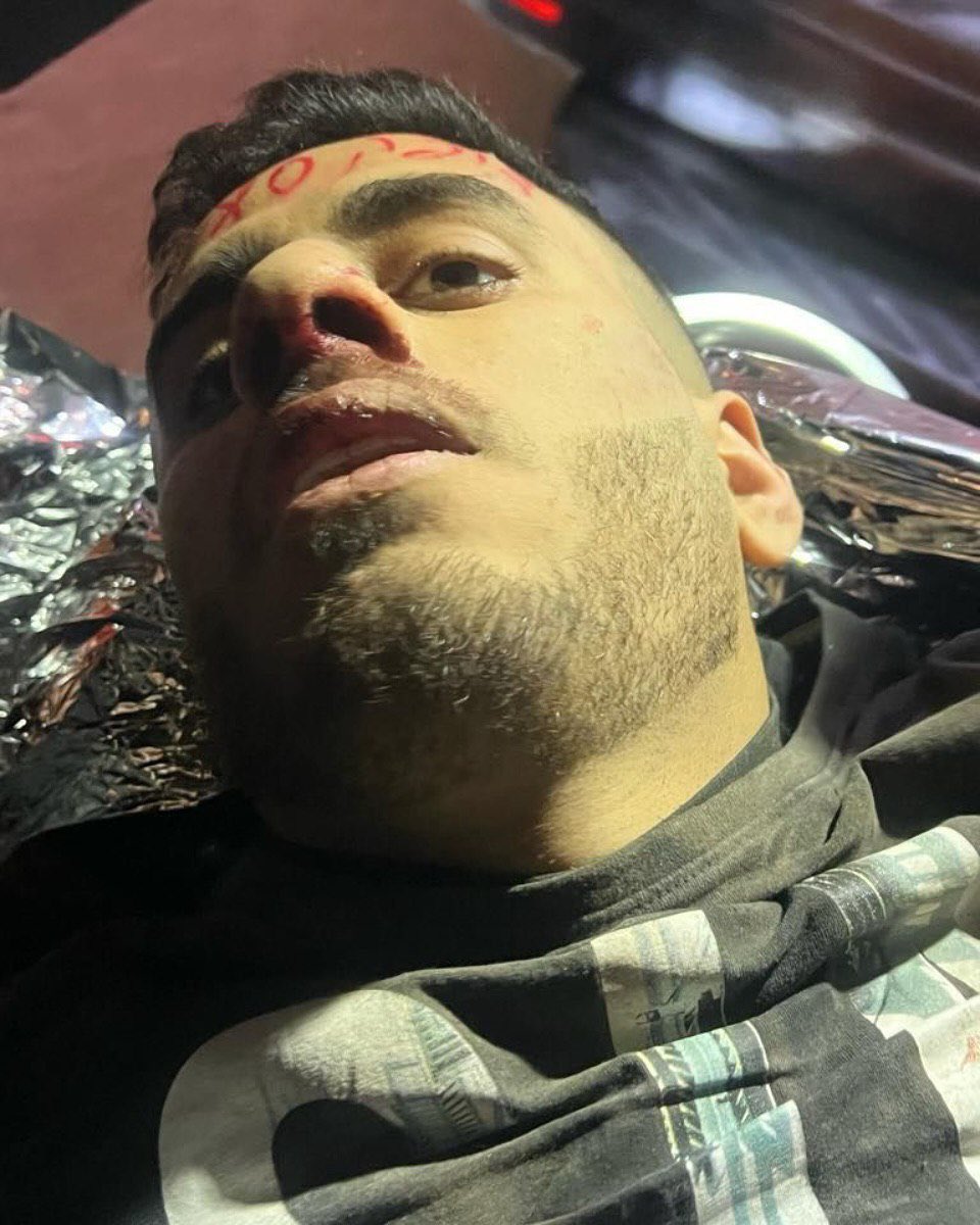 Arrest and shooting of Yusuf Sarour in Ni’lin