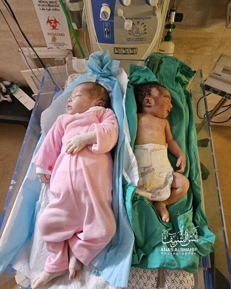 15 Children Dead at Kamal Odwan Hospital Gaza