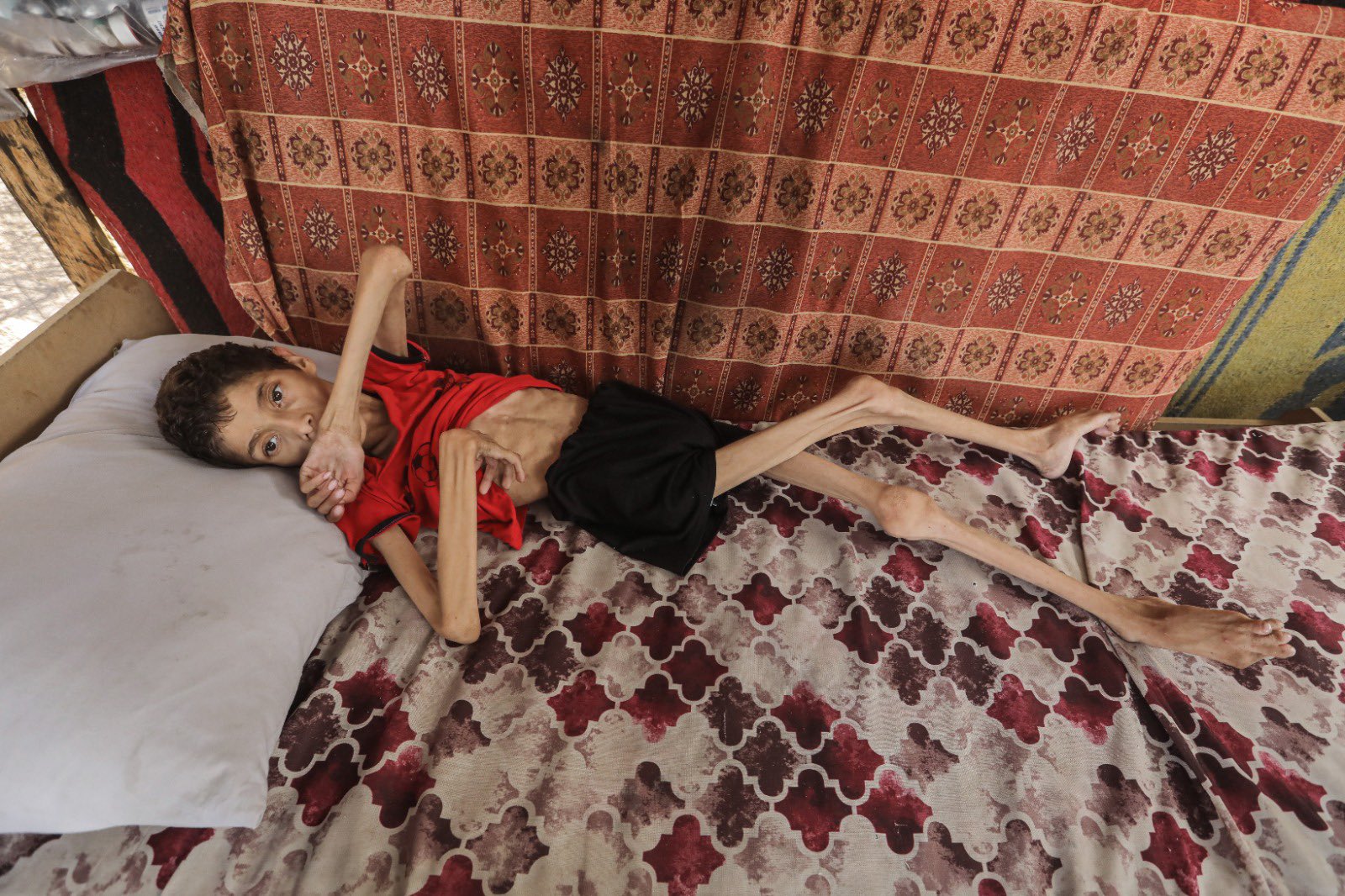 Ahmad al Najjar’s Health Crisis and Displacement