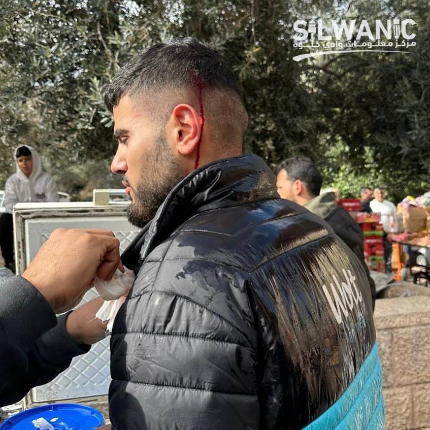 Palestinian injured in attack by occupation forces at Jerusalem’s Lion’s Gate