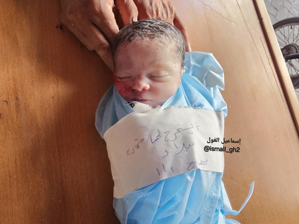 Fetus Malak Hossam Hassanein killed by Israel during cesarean