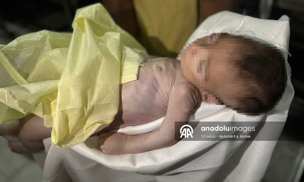 Nourrisson mort de faim à Gaza, crise humanitaire s’aggrave