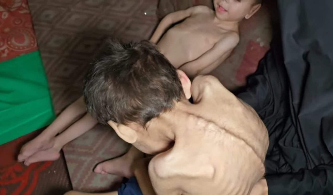 Deaths from Hunger in Gaza Strip Amid Aid Restrictions