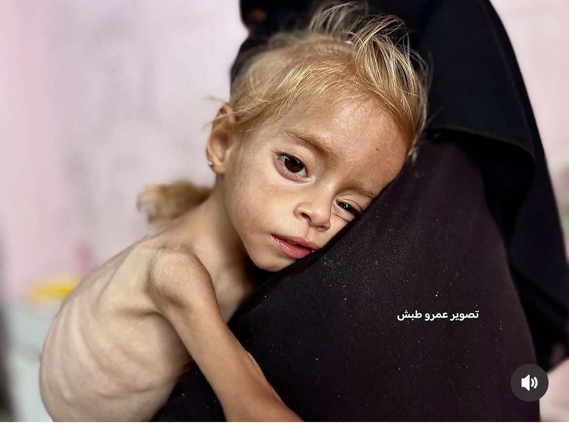 Israel Accused of Starving 2.3 Million Palestinians in Gaza