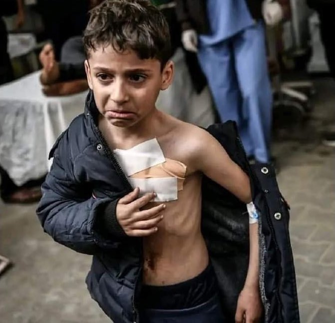 Wounded boy in Gaza appeals for help and response