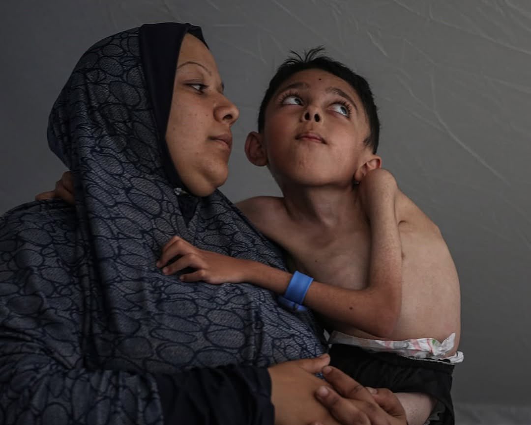 Gaza Humanitarian Crisis: Mohammad’s Medical Emergency