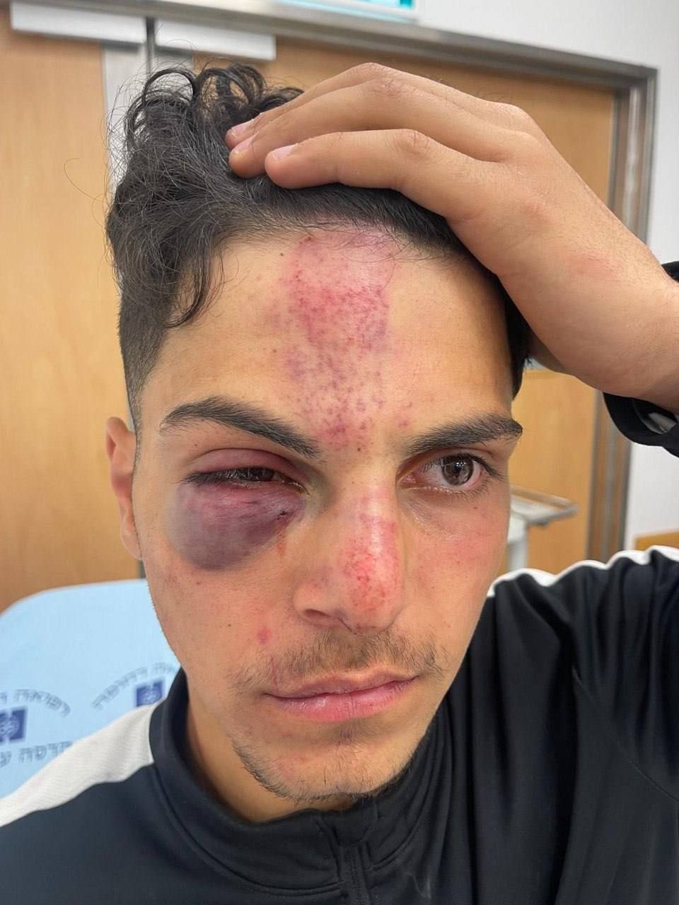 Israeli settlers violently attack Palestinian boy in Jerusalem Old City