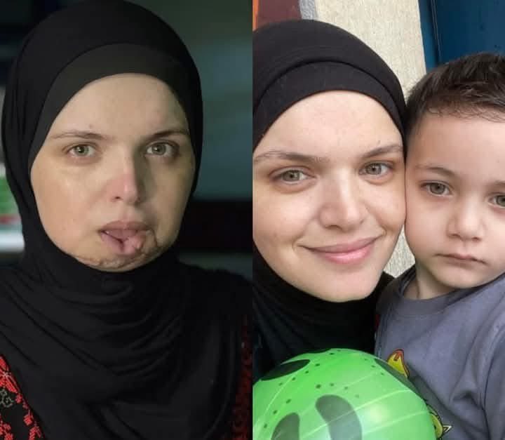 Journalist Dohaa Al-Sayyifi Survives Gaza Massacre, Loses Family