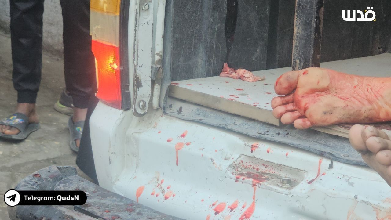 Israeli Air Strike Injures Palestinians at Gaza City School
