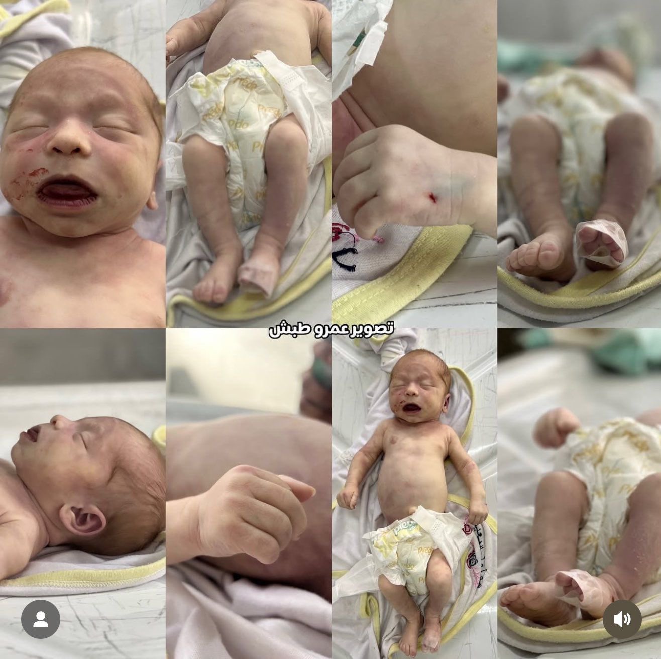 Newborn Dies from Cold in Gaza Displacement Tents