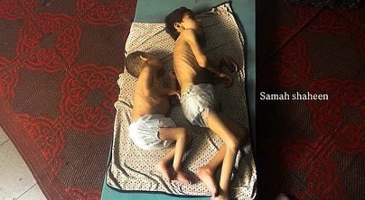 Skeletal bodies reveal merciless famine in Gaza Strip