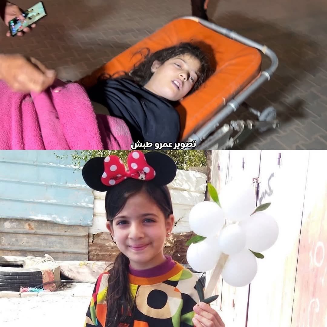 Child casualty from Israeli air strike in Khan Younis