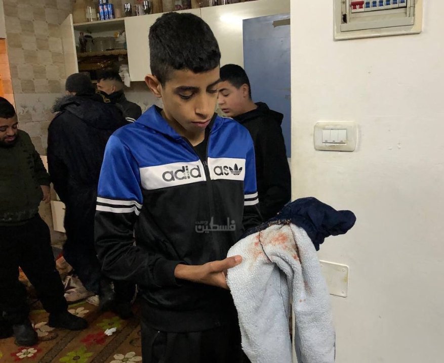 Israeli Police Dog Injures 4-Year-Old Boy in West Bank Raid