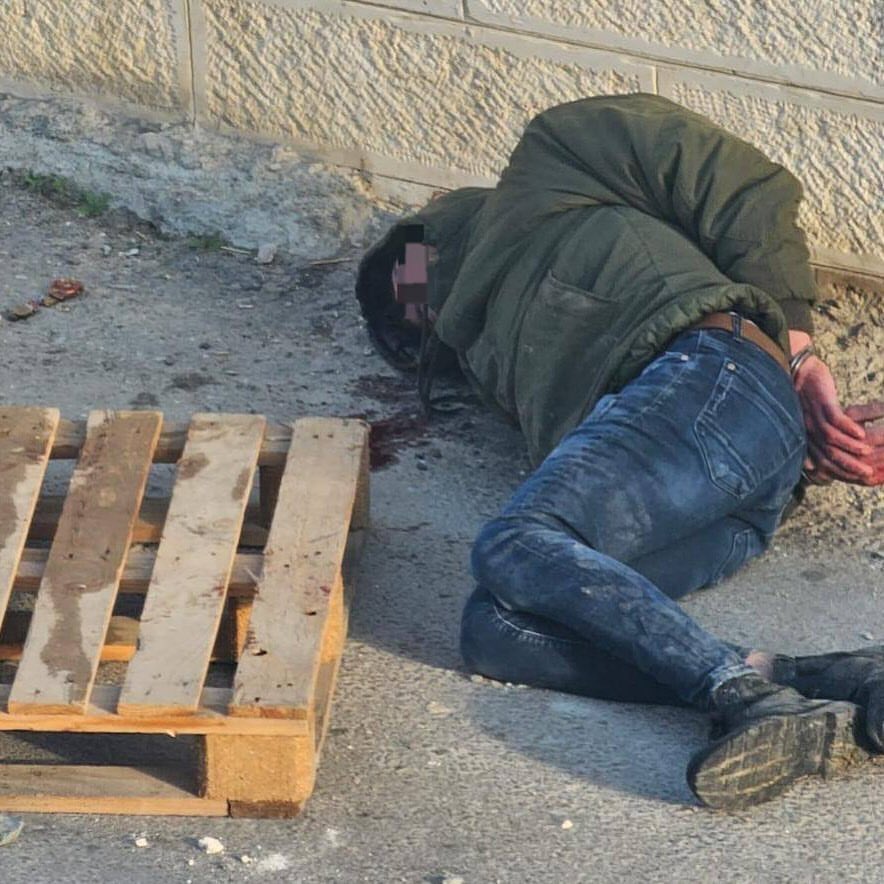 Palestinian Youth Detained After Assault in Jerusalem