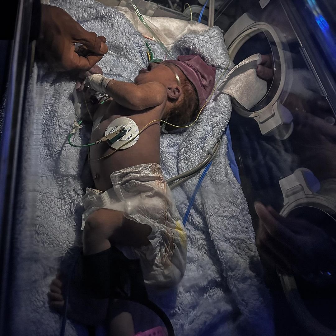 Al-Aqsa Hospital Loses Power Amid Fuel Shortage Crisis