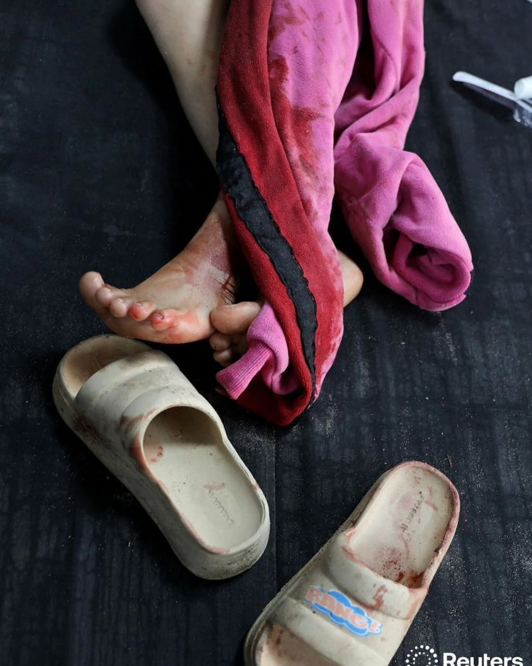 Gaza Situation Following Continued Occupation Aggression