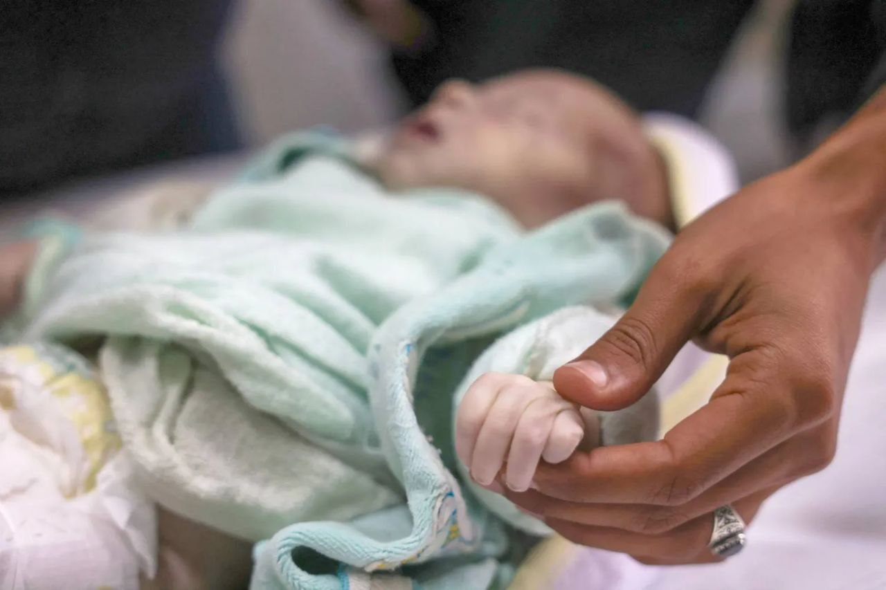 Weather System Deaths in Gaza Strip Hospitals