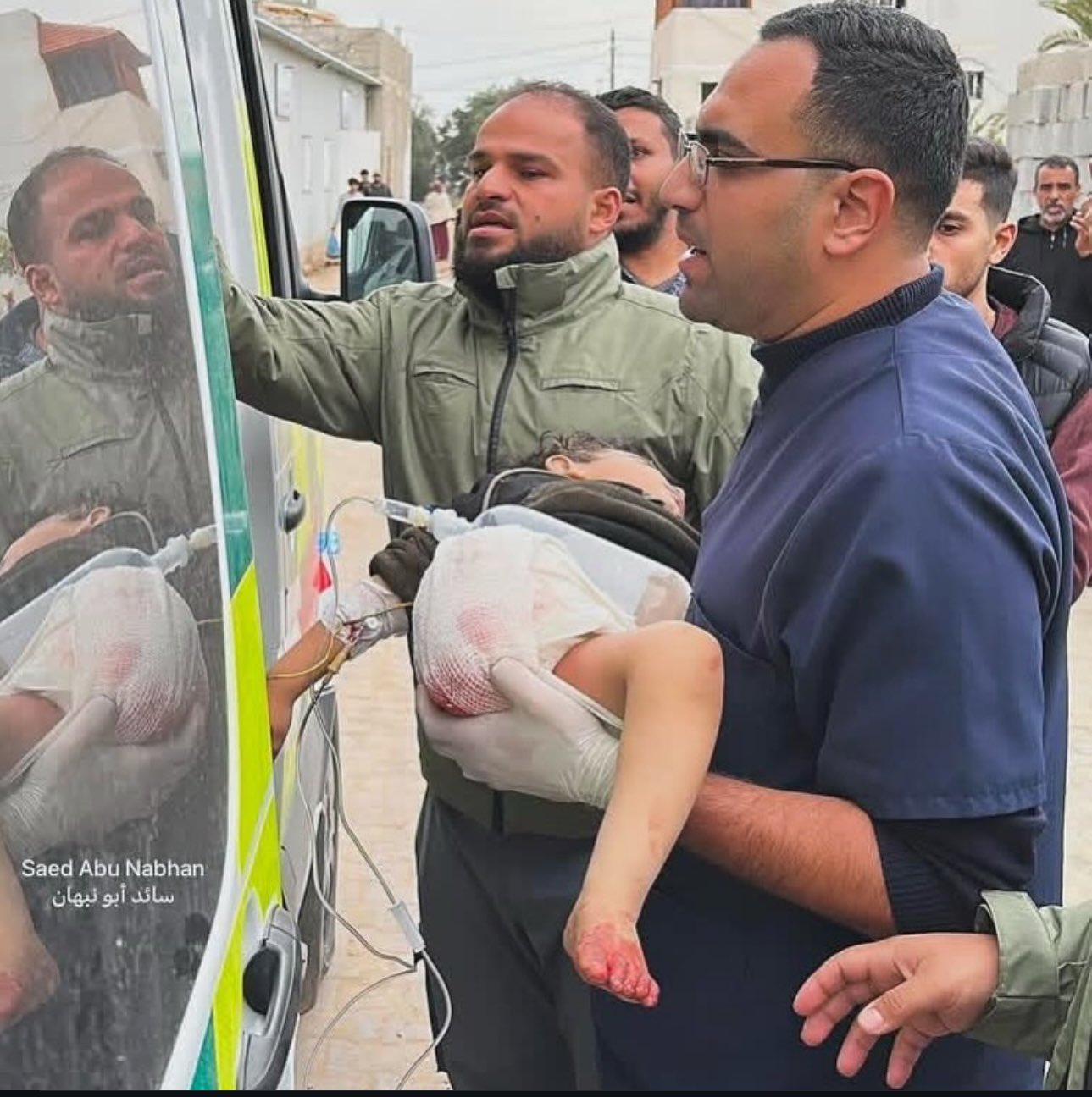 Child Injured in Israeli Airstrike Nusairat Gaza