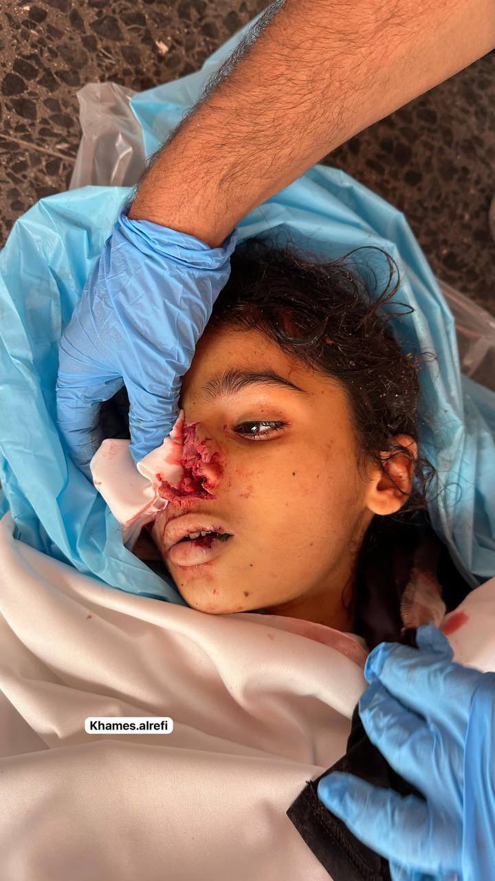 Civilian Deaths Reported in Israeli Bombing