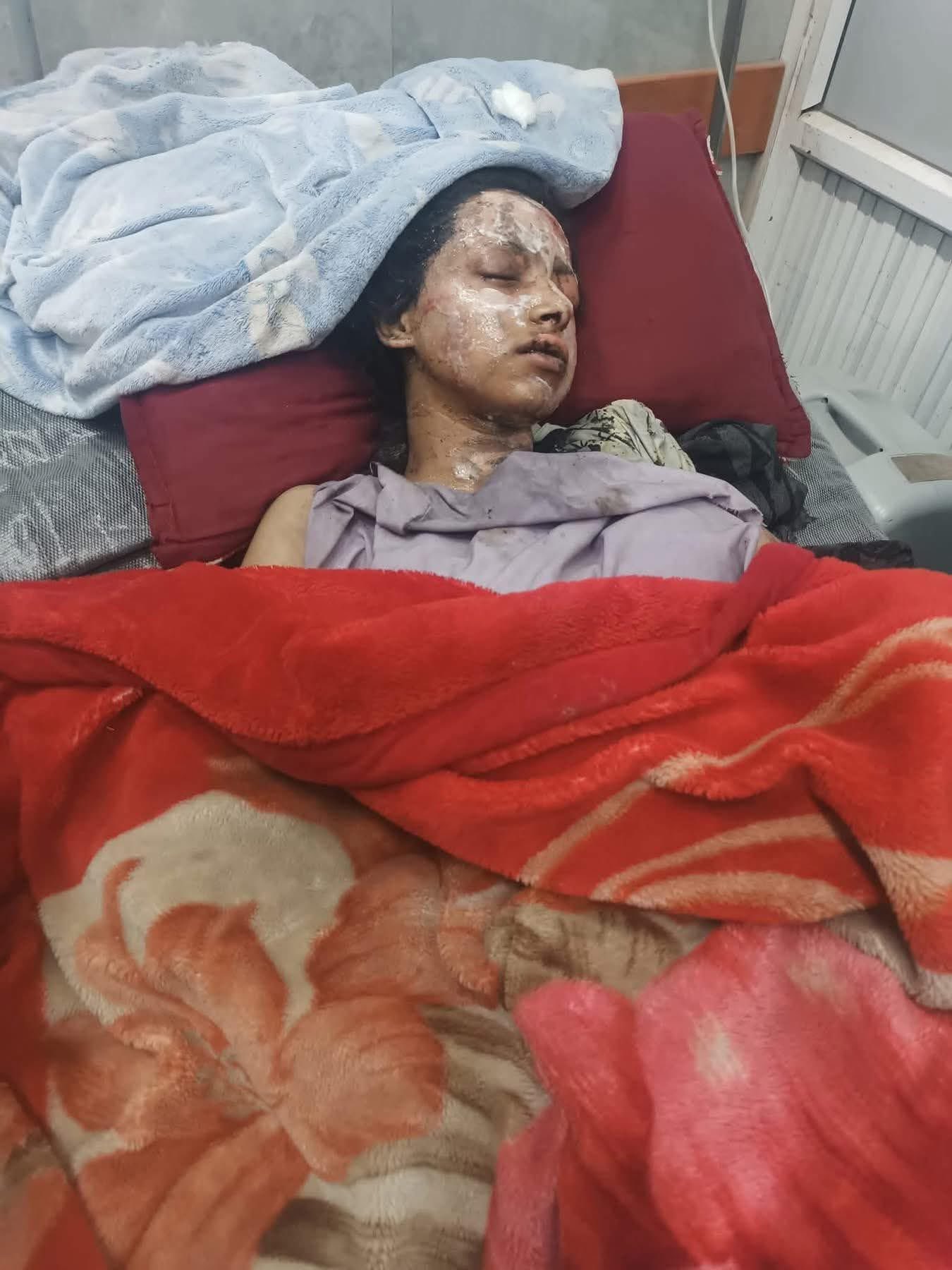 Young Girl Sole Survivor After Israeli Airstrike Kills 14 Family Members