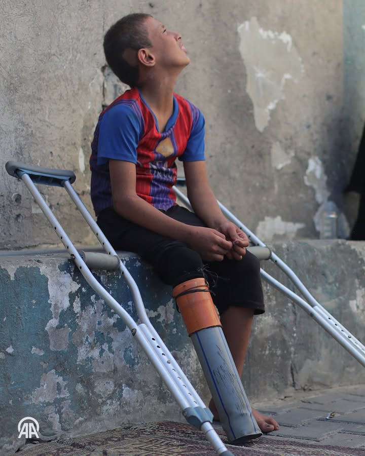 Nine-Year-Old Rateb Loses Mother and Leg in Gaza Strike