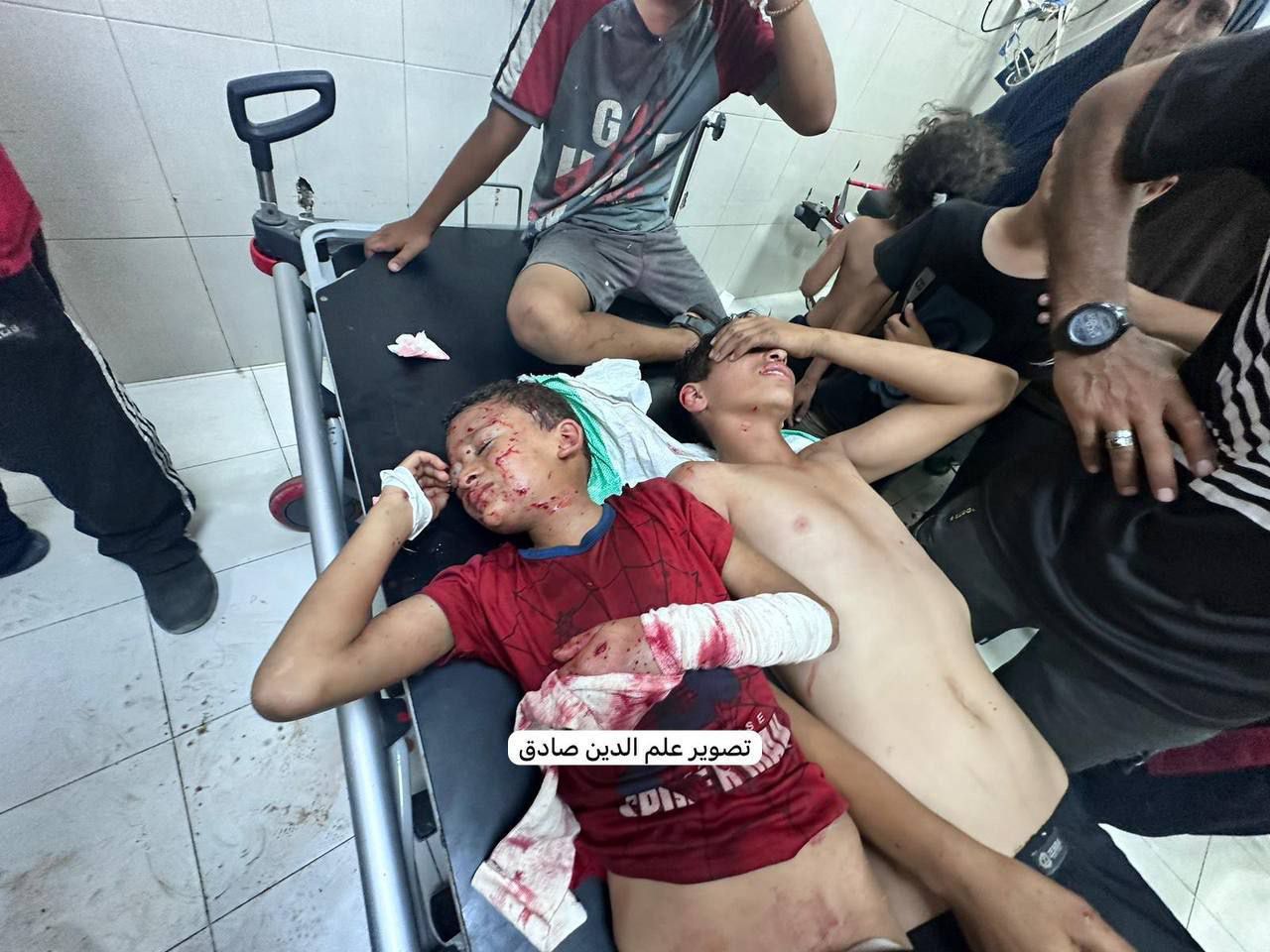 Children injured in explosion near Al-Aqsa University Khan Yunis