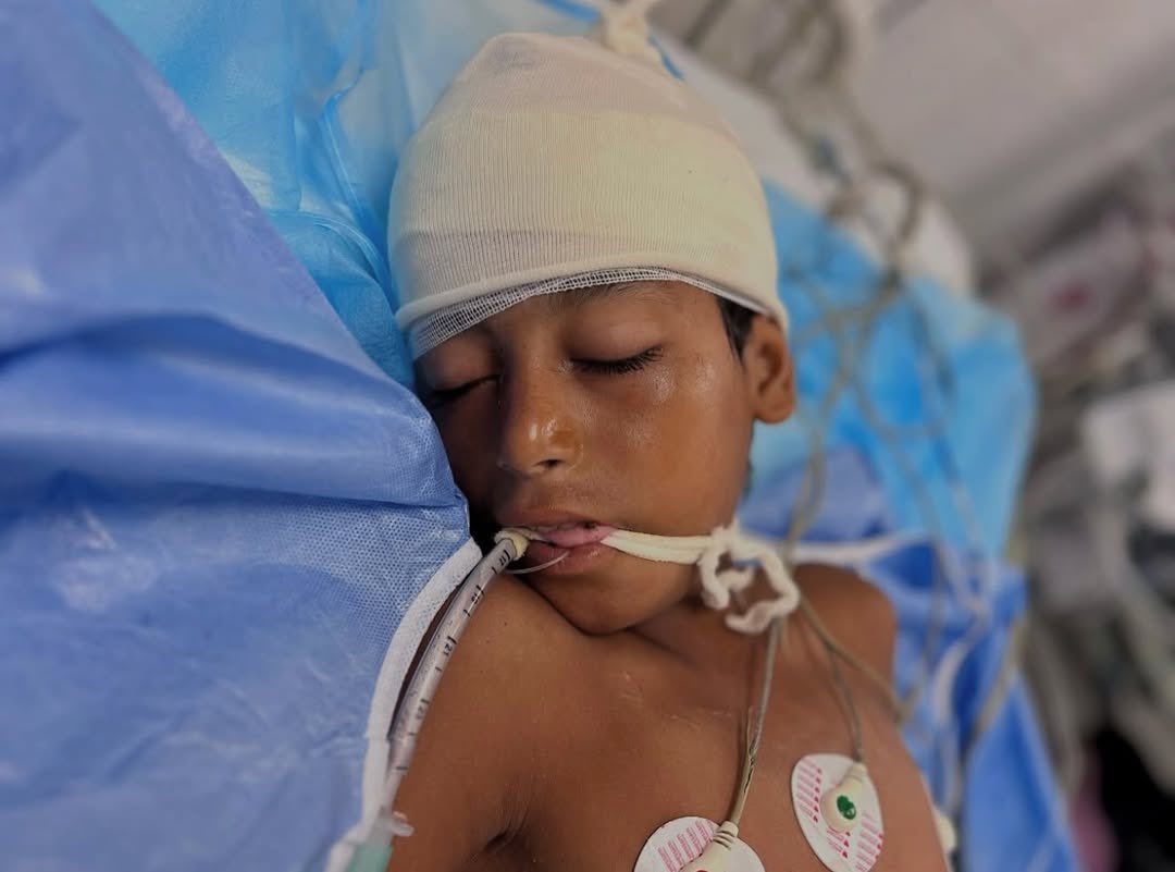 Child with severe head injury admitted to Nasser Medical Complex PICU