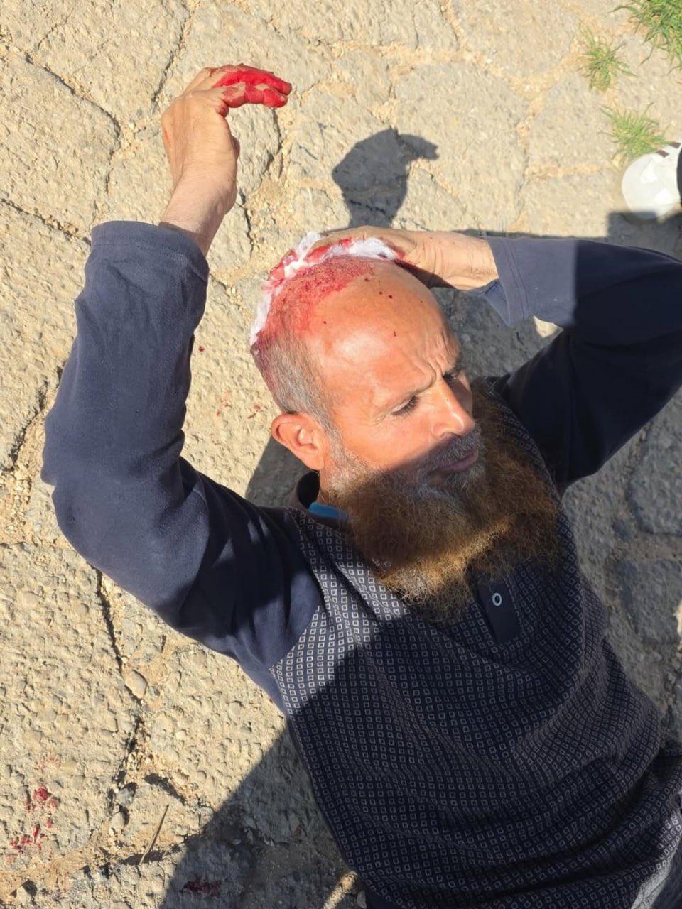 Sheikh Said La’Mour wounded by Israeli forces in West Bank