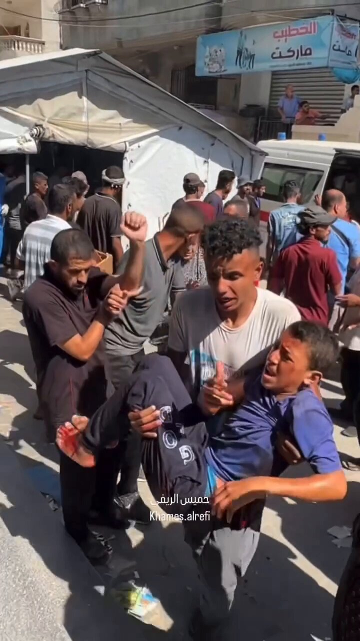 Gaza hospitals overwhelmed with injured children footage