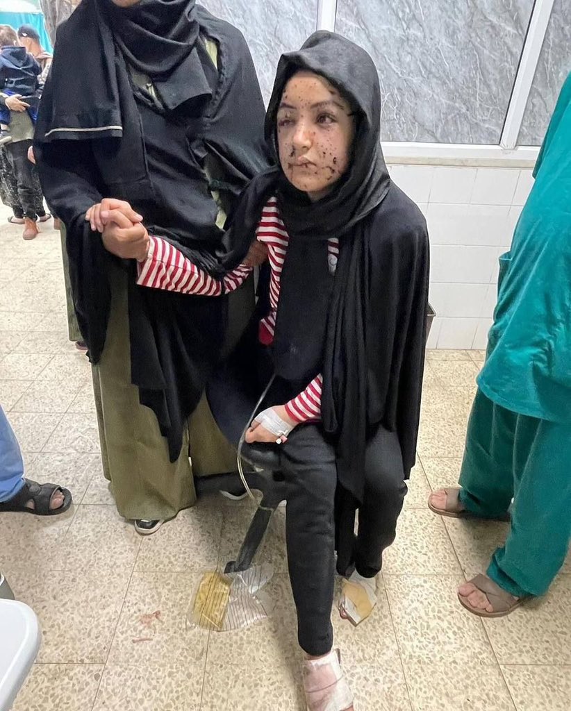 Children injured in Israeli strikes on central Gaza