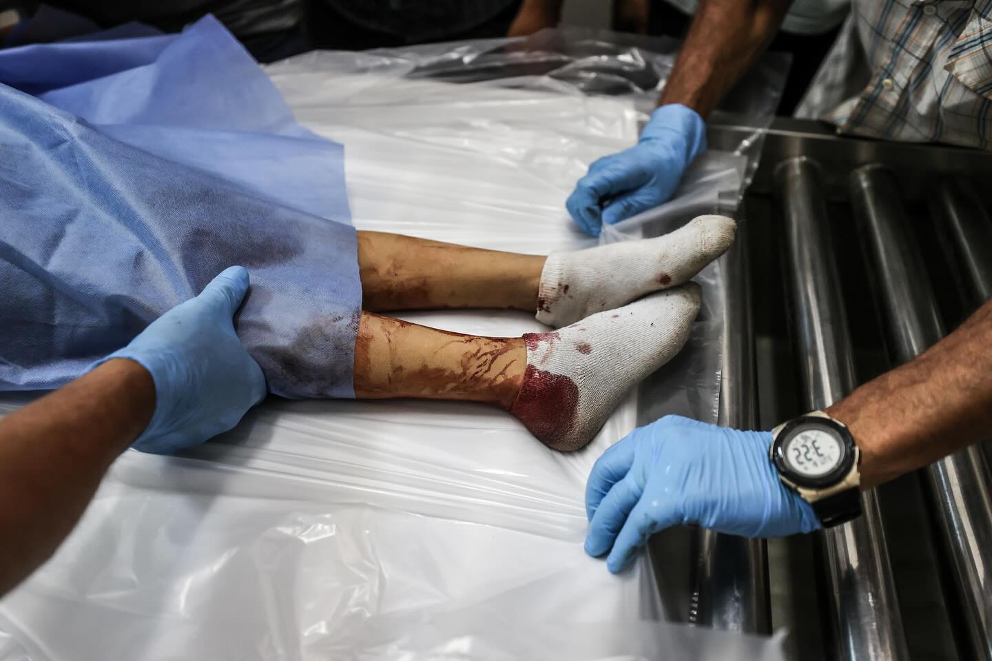 Palestinian child killed in Israeli attacks on Gaza City
