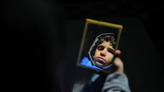 14-year-old loses eye in Israeli strike, dreams of football return