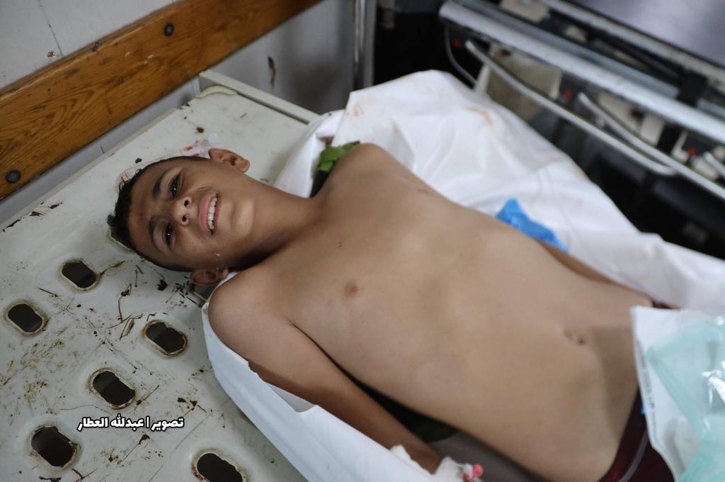 Israeli Military Operations Kill 79 Civilians in Gaza