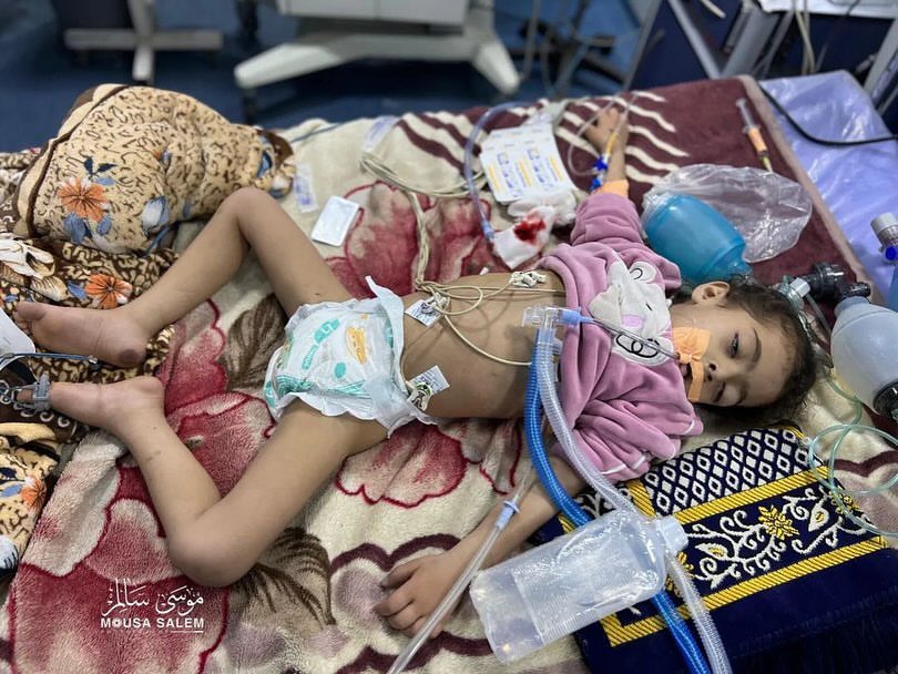 Girl Maria Facing Death at Gaza’s Kamal Adwan Hospital