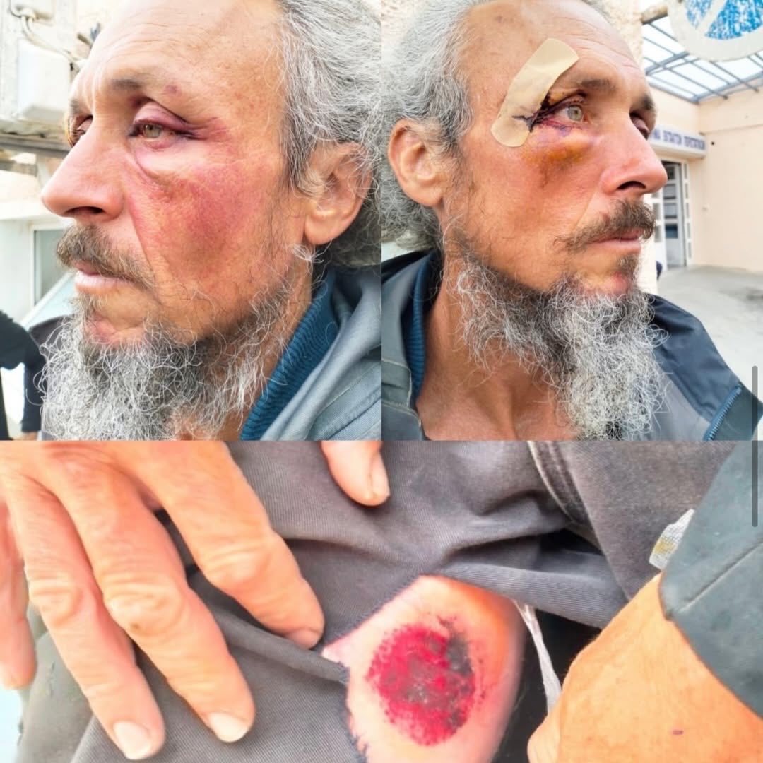 Sumud Flotilla: Documentation of Alleged Assault During Arrest