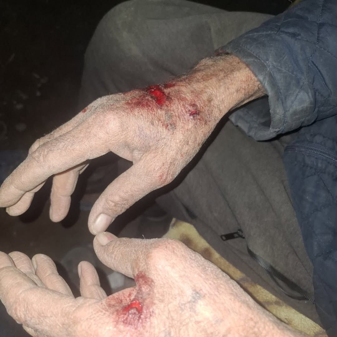 Palestinian man assaulted by settlers in Jordan Valley, activists injured
