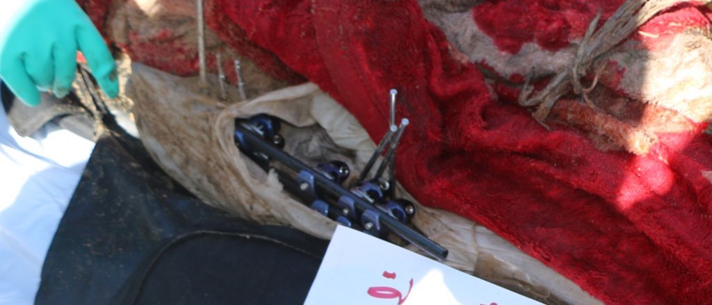 Alleged Execution Evidence at Al Shifa Hospital
