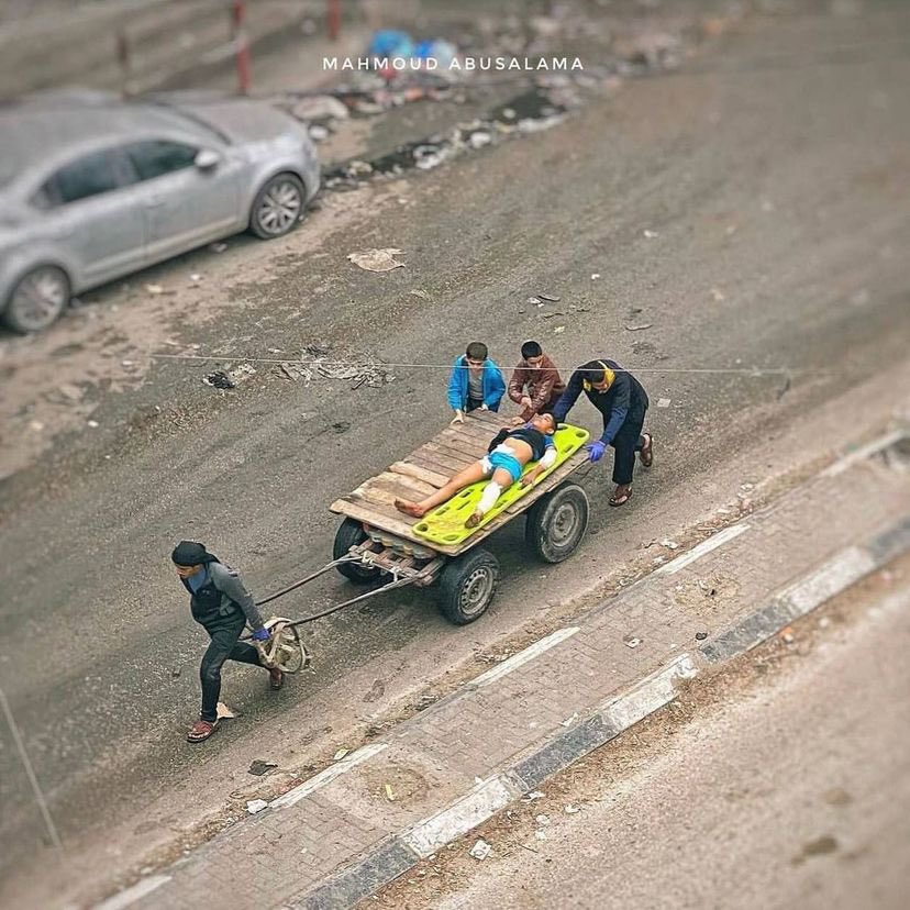 Injured child taken to hospital in Jabalia camp