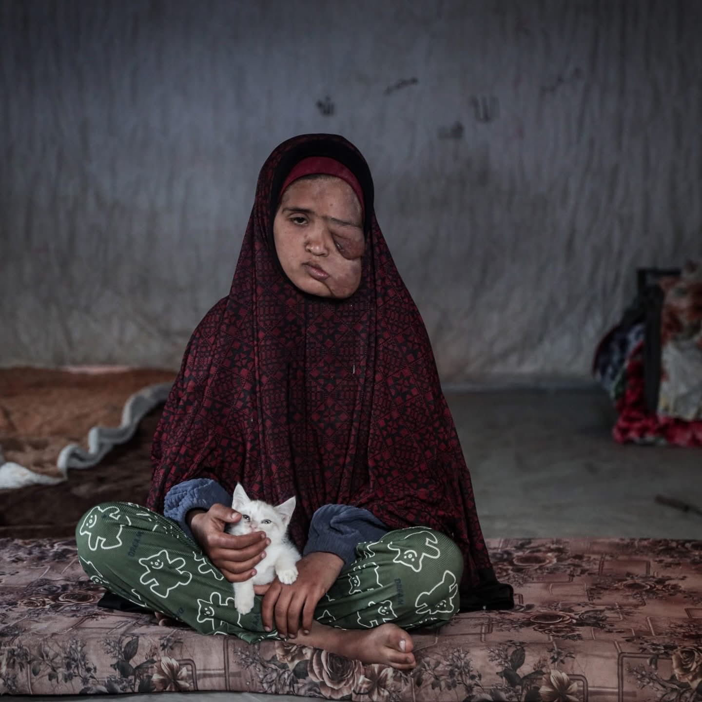 Palestinian Teen Battles Cancer Access Crisis in Gaza