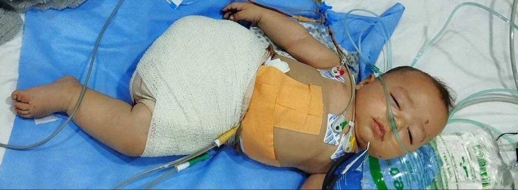 Palestinian Deaths During Month-Long Ceasefire