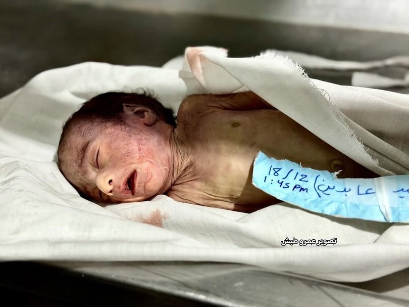 Infant dies in Gaza cold wave death toll reaches thirteen