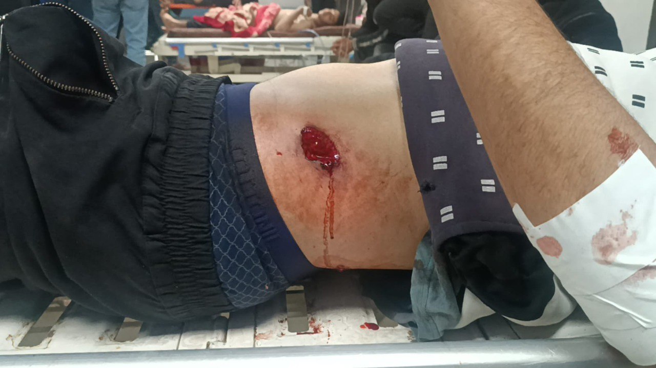 IOF Opens Fire on Civilians at Kuwait Roundabout in Gaza