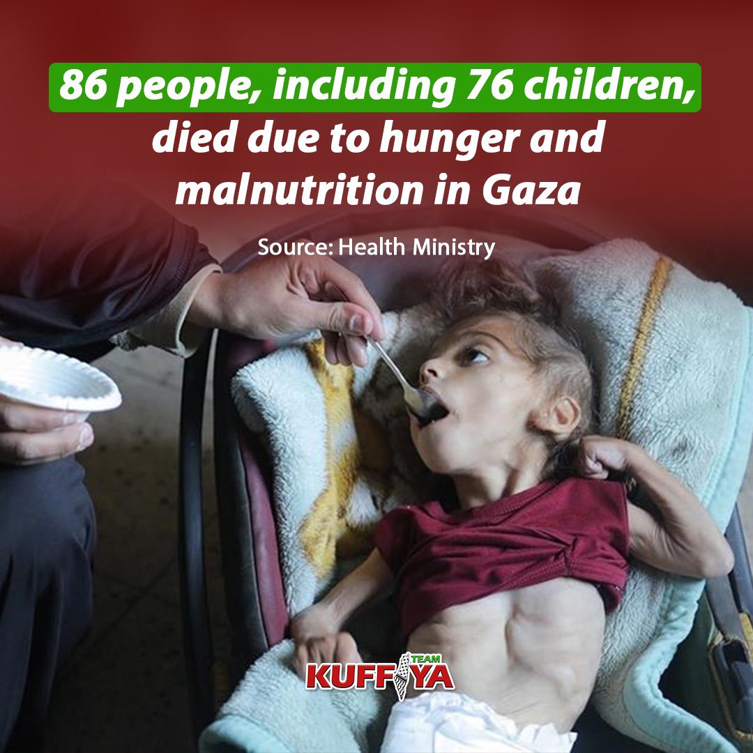 86 Deaths in Gaza from Hunger and Malnutrition Due to Blockade
