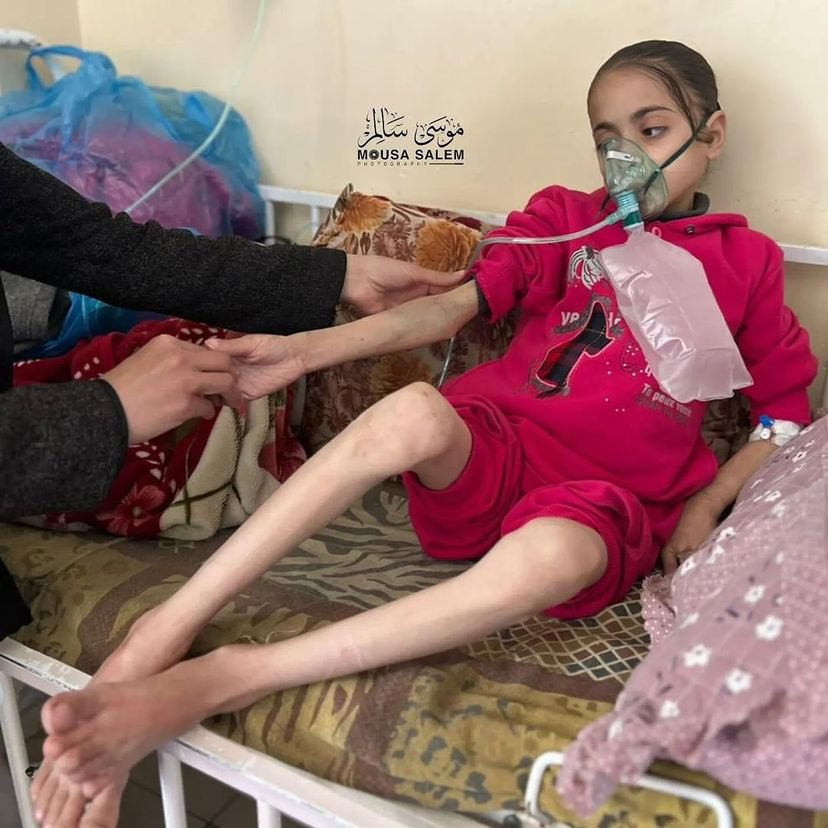 Little girl Nour Al Huda faces death from lack of food and dehydration.