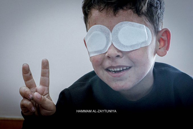 Gaza Eye Hospital Reports 1,200 New Blindness Cases in Two Weeks