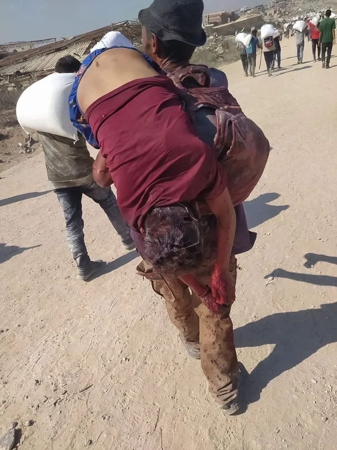 Civilian casualties during Israeli occupation operations