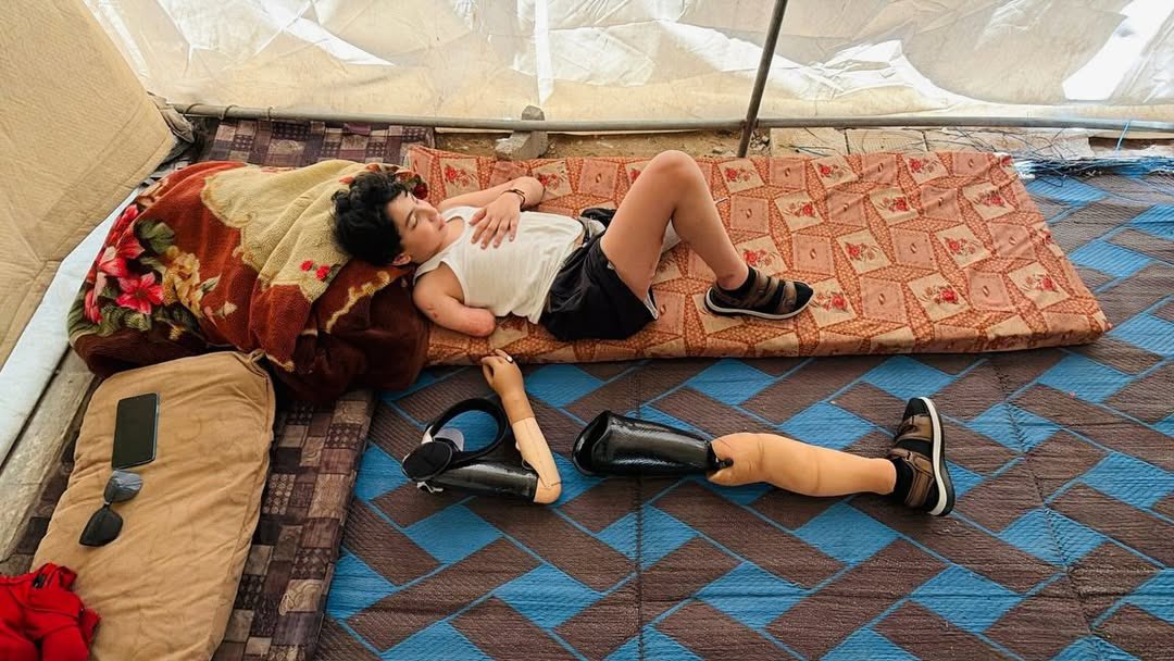 Palestinian survivor returns home with prosthetic limbs