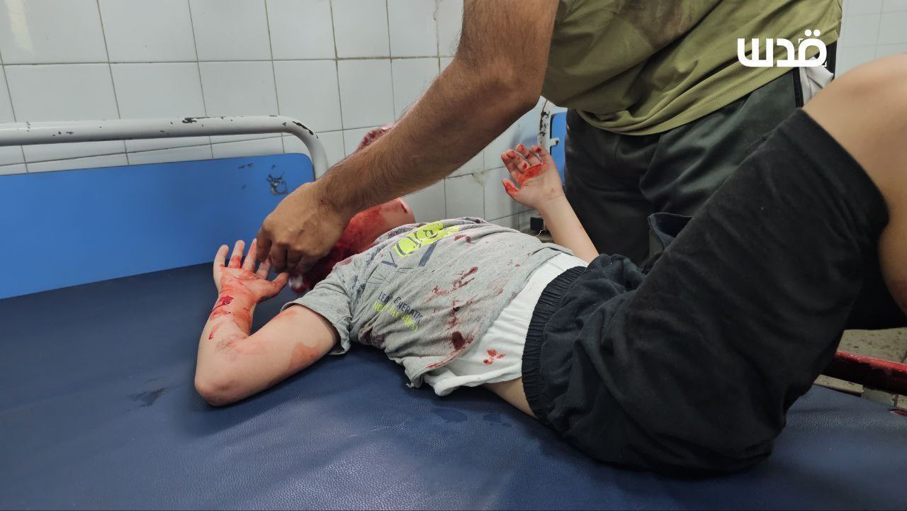 Palestinian Injured in Israeli Airstrike on Gaza City